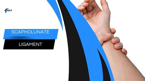 test for scapholunate ligament tear|scapholunate ligament physical exam.